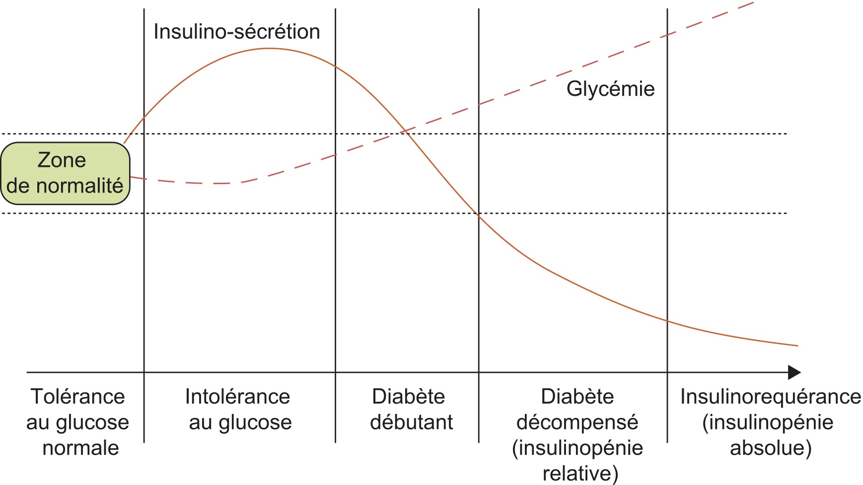 Comment tester le diabète  Savoir comment diagnostiquer le diabète de type  2